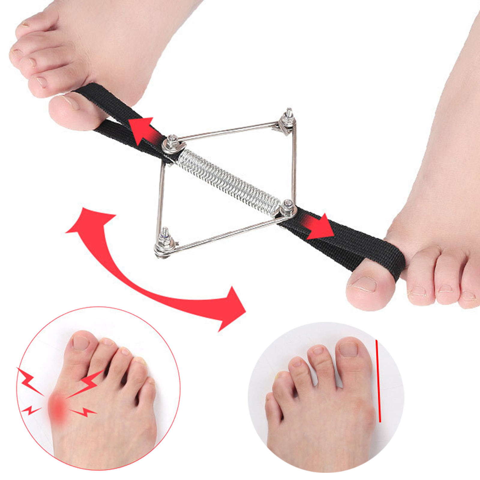 Bunion Corrector Nylon Steel S - Pilates Yoga Wellness avaliação e preço